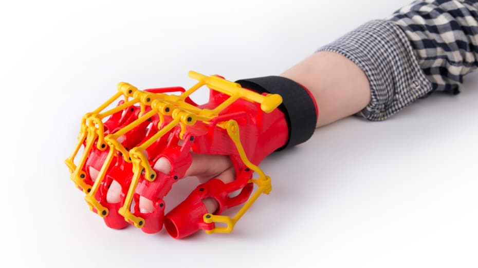3d-printed-orthosis-1.jpg