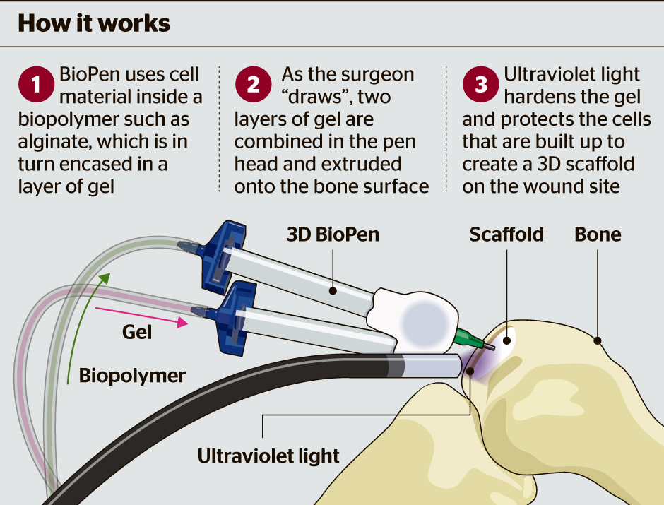 bio-pen-graphic_496216a.jpg